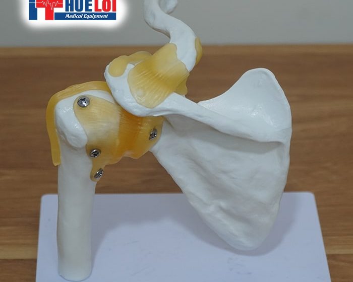 Mô hình giải phẫu xương bả vai và khớp vai