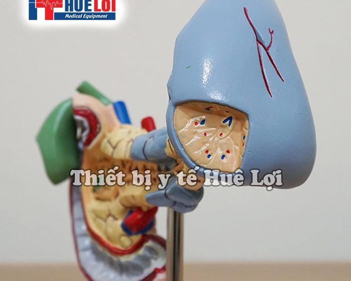 MÔ HÌNH BỆNH LÝ VÙNG TỤY
