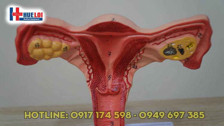 Tử cung và những bệnh lý liên quan đến tử cung phụ nữ  Pink Ribbon