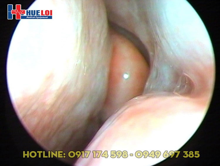 Máy nội soi tai mũi họng nguồn sáng lạnh XD-301