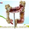 Mô hình khung đại tràng và các bệnh lý hay gặp