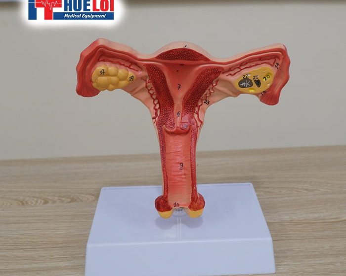 MÔ HÌNH GIẢI PHẪU TỬ CUNG VÀ BUỒNG TRỨNG