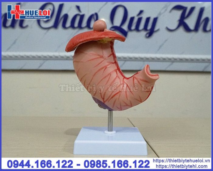 Mô hình bệnh lý dạ dày
