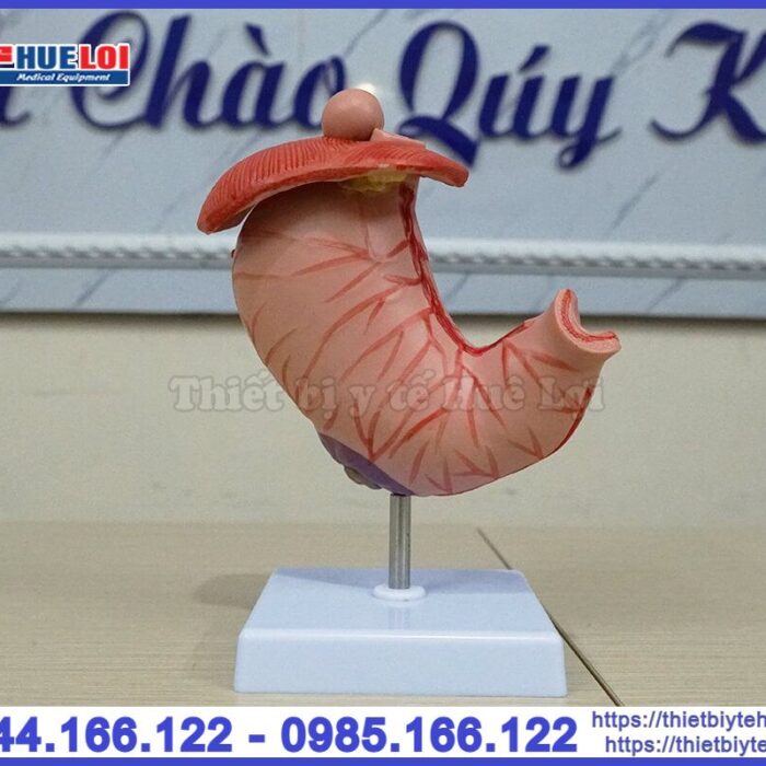 Mô hình bệnh lý dạ dày