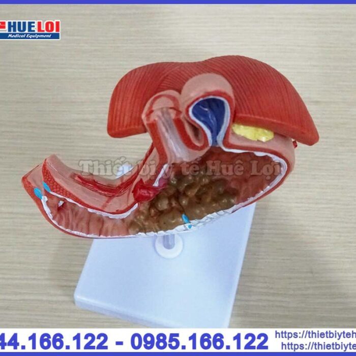 Mô hình bệnh lý dạ dày