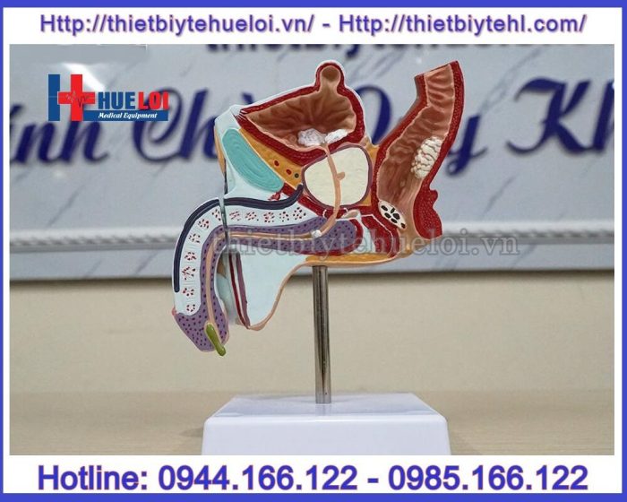 Mô hình giải phẫu bệnh lý hệ sinh dục nam