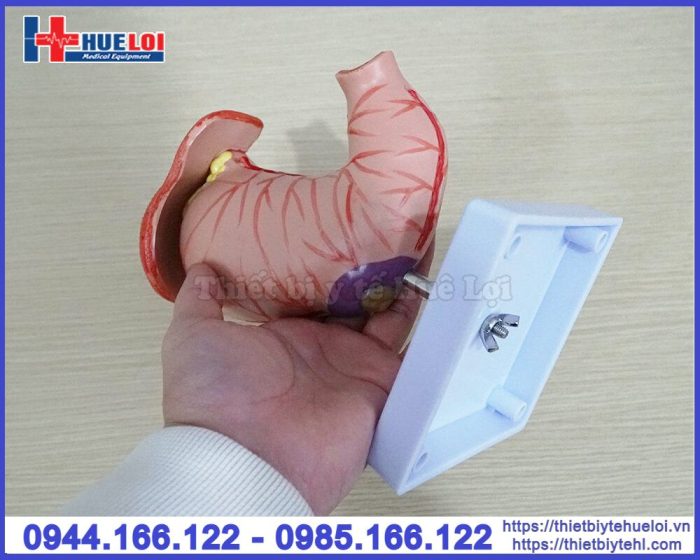 Mô hình bệnh lý dạ dày