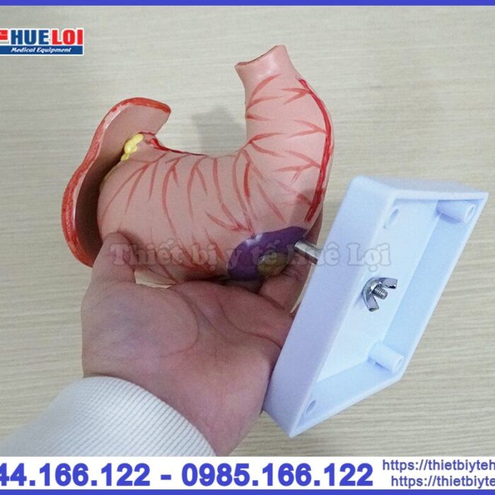 Mô hình bệnh lý dạ dày