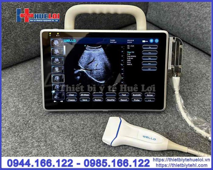 Máy siêu âm xách tay cảm ứng Well.D – P10