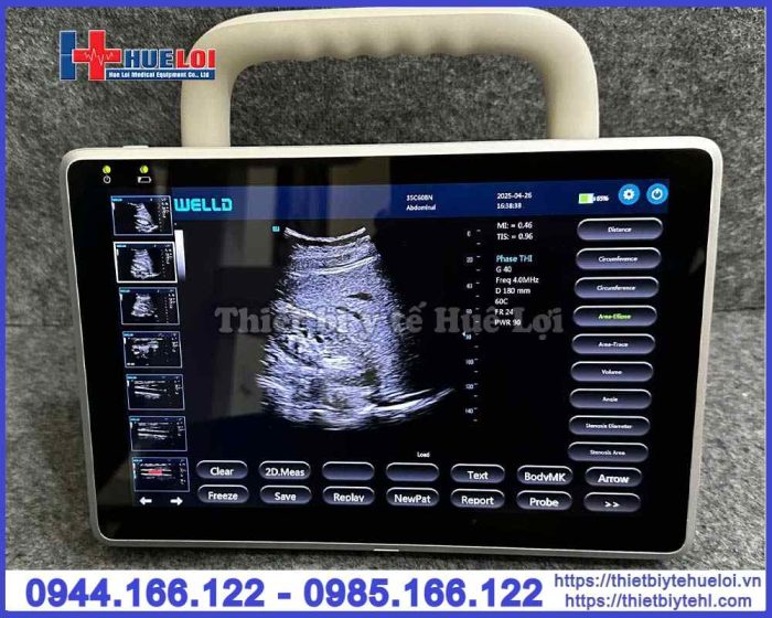 Máy siêu âm xách tay cảm ứng Well.D – P10