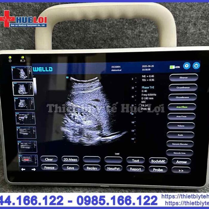 Máy siêu âm xách tay cảm ứng Well.D – P10