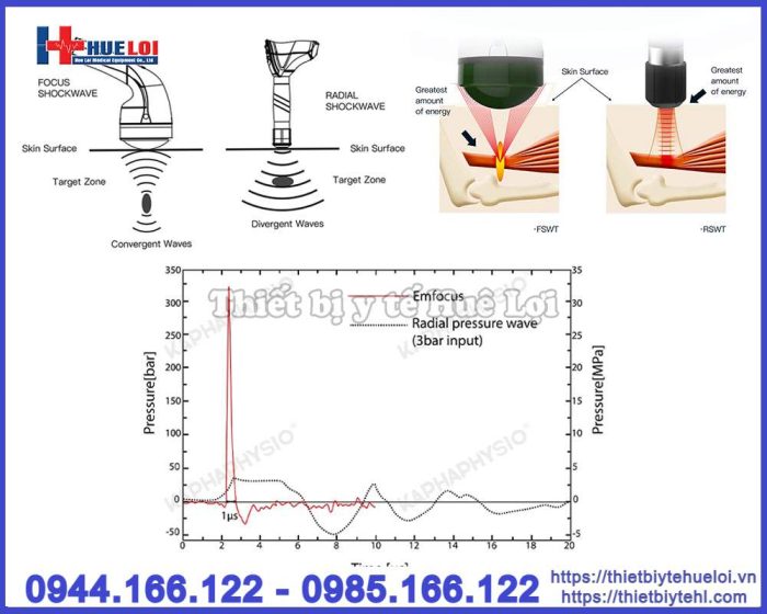 Máy xung kích hội tụ EMFOCUS-Bản cao cấp