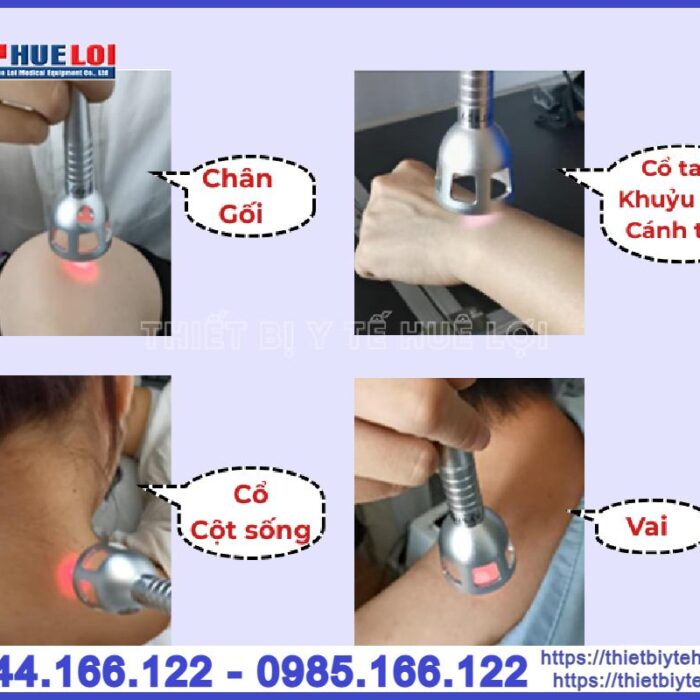 Máy laser diode công suất cao Texua EC30