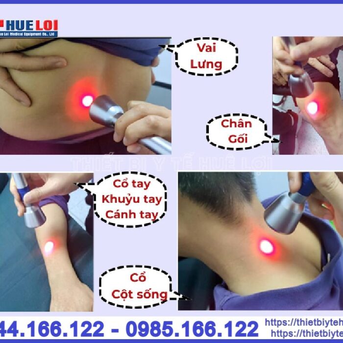 Máy laser diode công suất cao Texua EC30