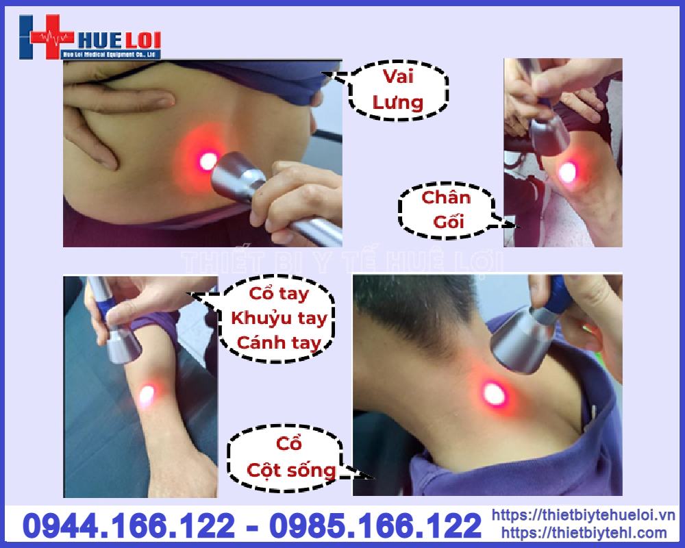 Máy laser diode công suất cao Texua EC30