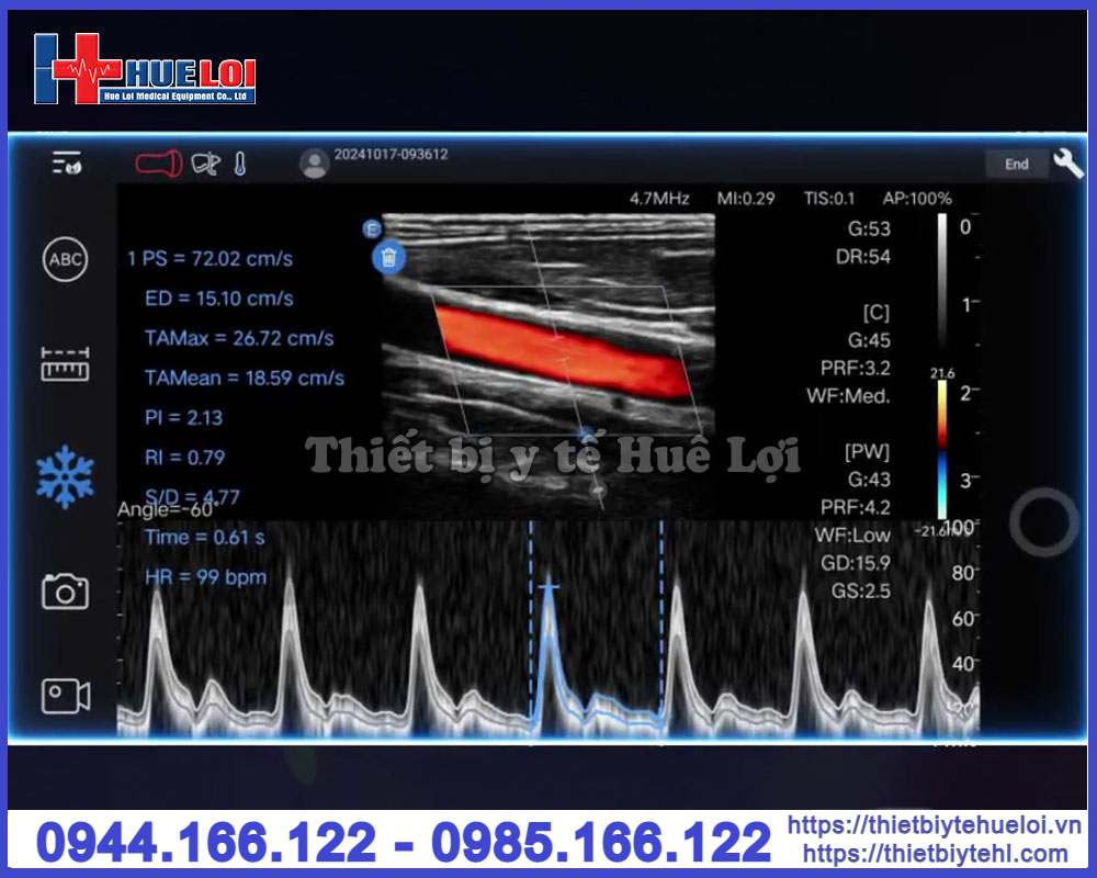 Máy siêu âm mini cầm tay EDAN Nano C5 EXP