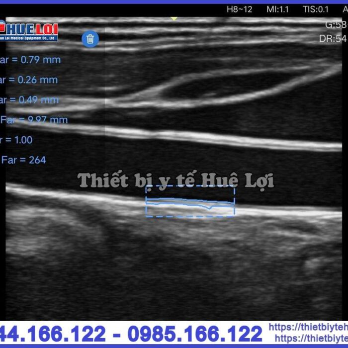 Máy siêu âm cầm tay EDAN Nano L12 EXP