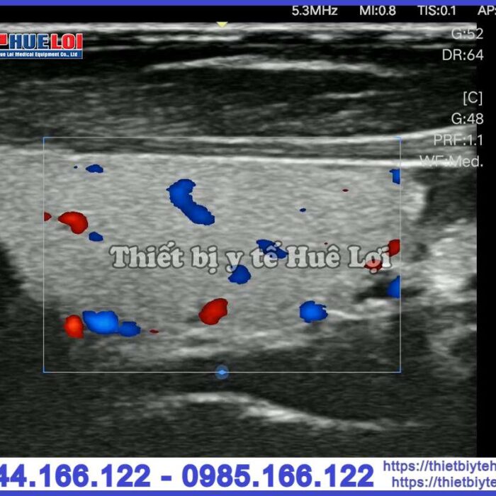 Máy siêu âm cầm tay EDAN Nano L12 EXP