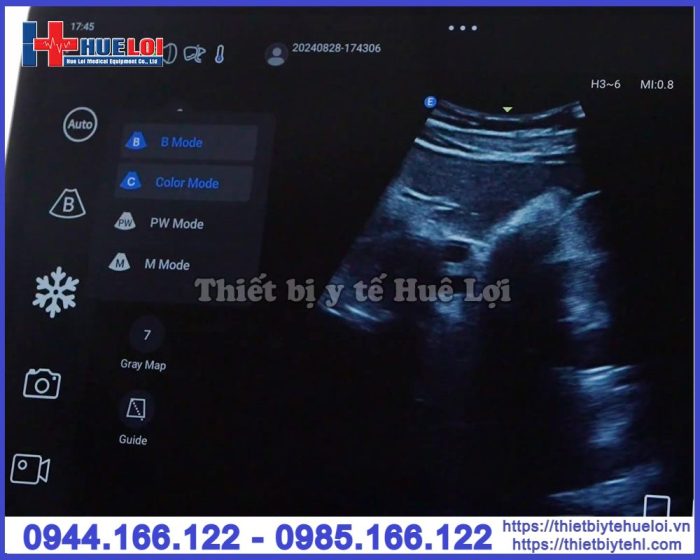 Máy siêu âm cầm tay EDAN Nano L12 EXP