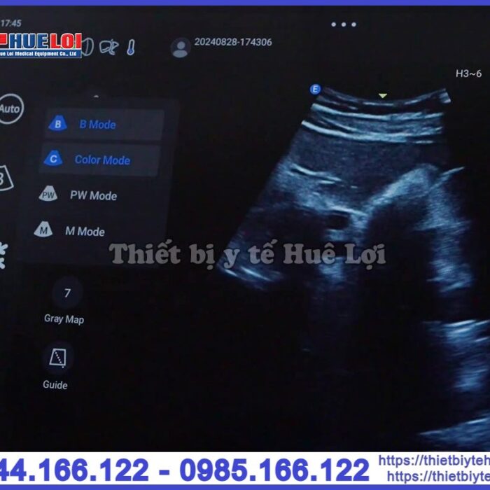 Máy siêu âm cầm tay EDAN Nano L12 EXP