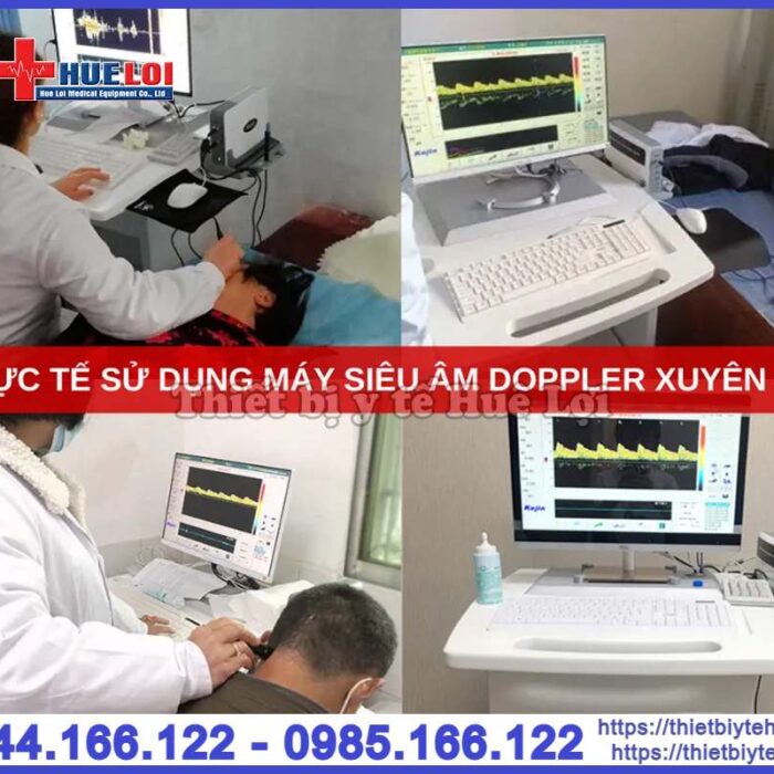 Máy siêu âm Doppler xuyên sọ