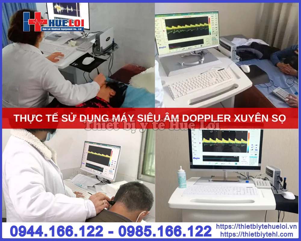 Máy siêu âm Doppler xuyên sọ