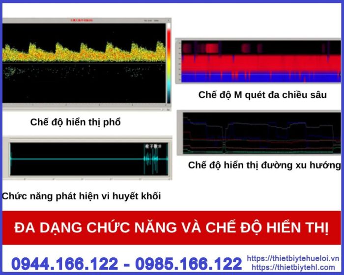 Máy siêu âm Doppler xuyên sọ