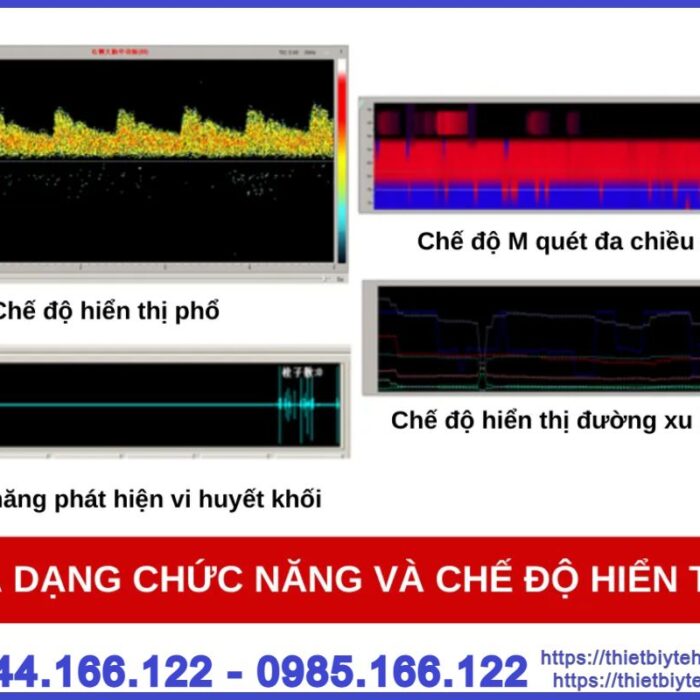 Máy siêu âm Doppler xuyên sọ