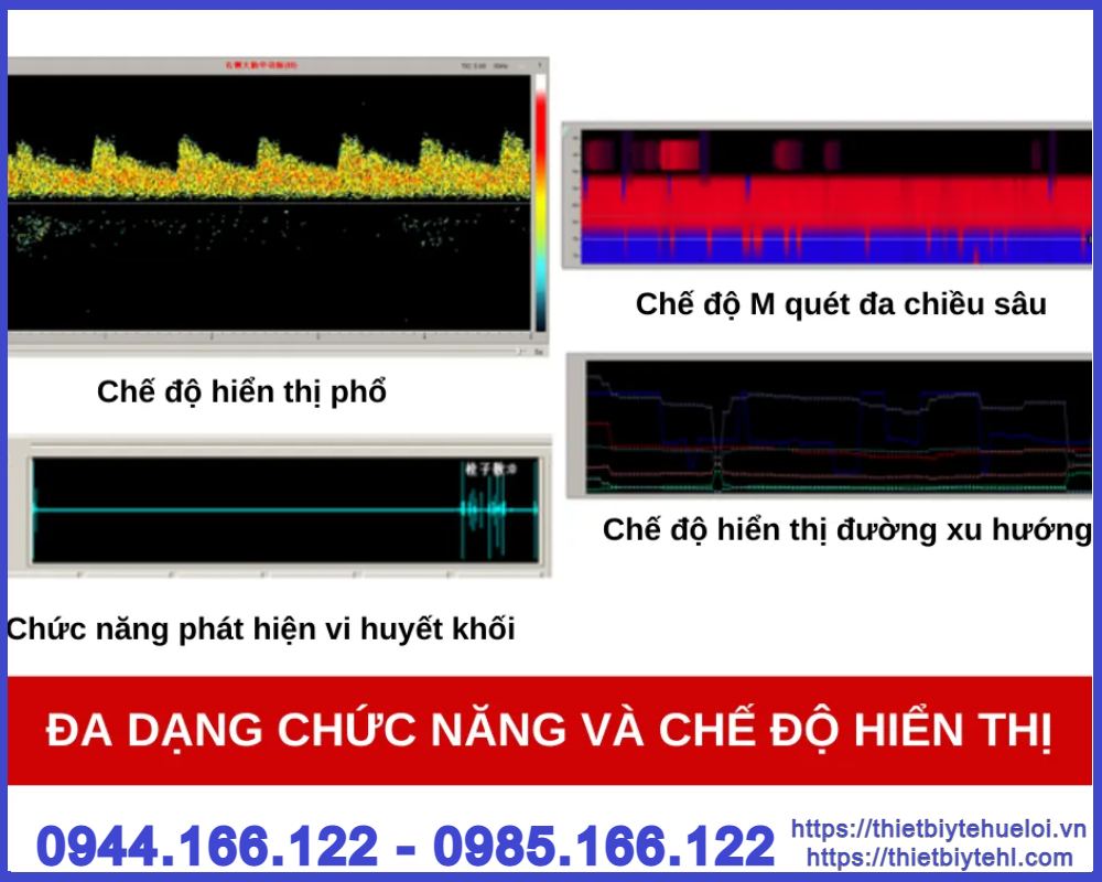 Máy siêu âm Doppler xuyên sọ