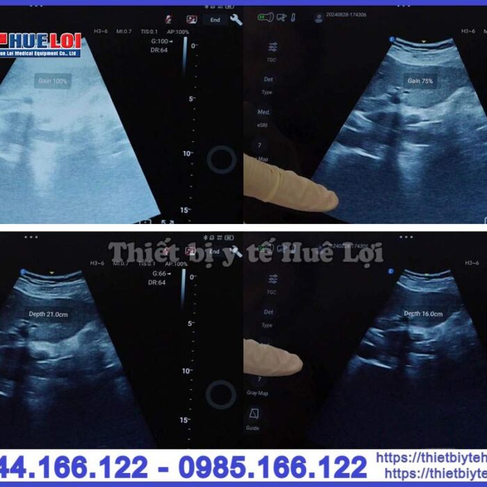 Máy siêu âm mini cầm tay EDAN Nano C5 EXP