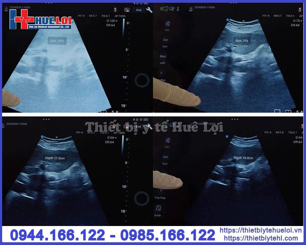 Máy siêu âm mini cầm tay EDAN Nano C5 EXP