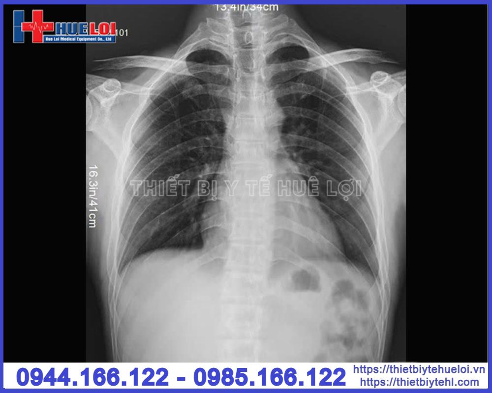 Máy chụp X-quang cố định