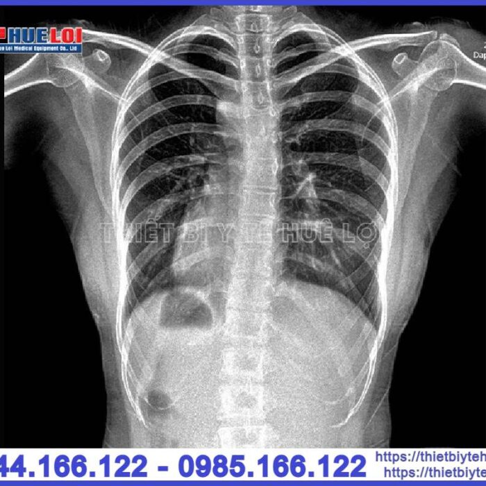 Máy chụp X-quang cố định