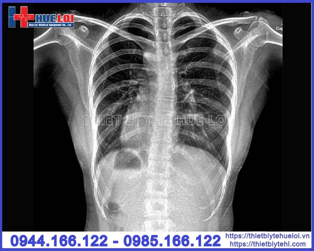 Máy chụp X-quang cố định