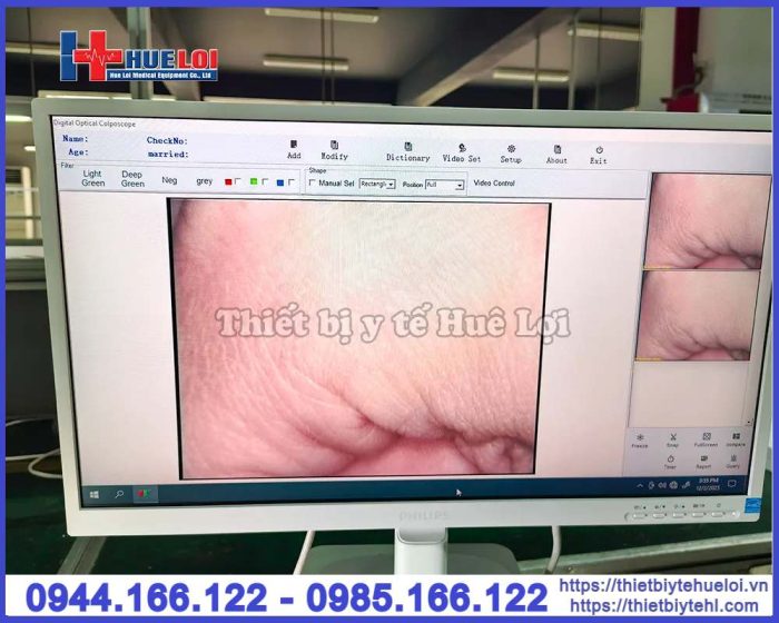 Máy soi cổ tử cung SW-302
