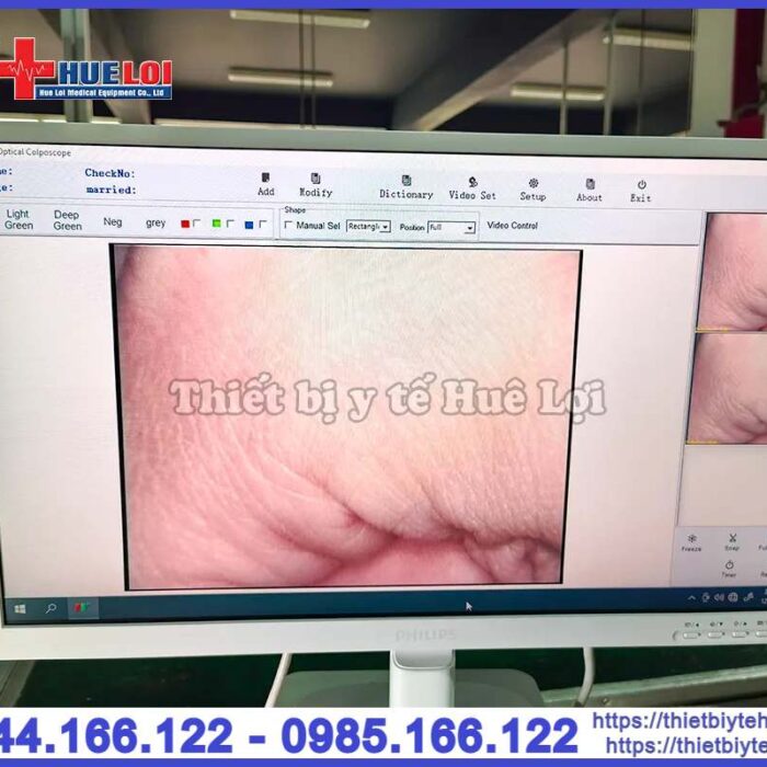 Máy soi cổ tử cung SW-302