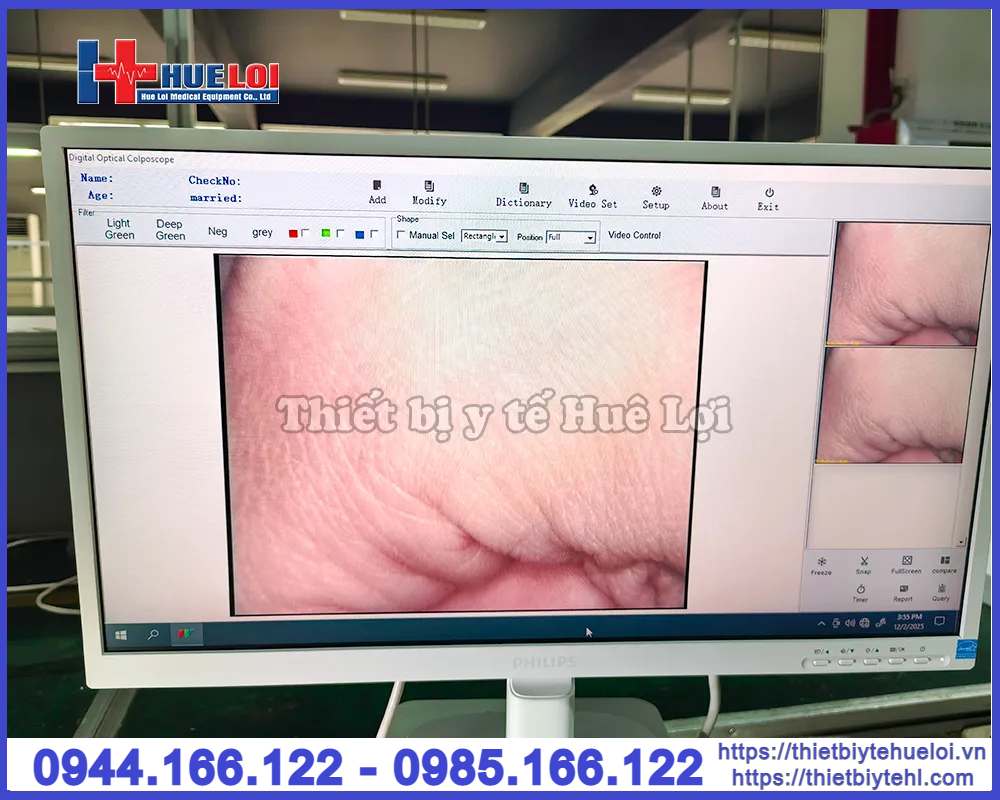 Máy soi cổ tử cung SW-302